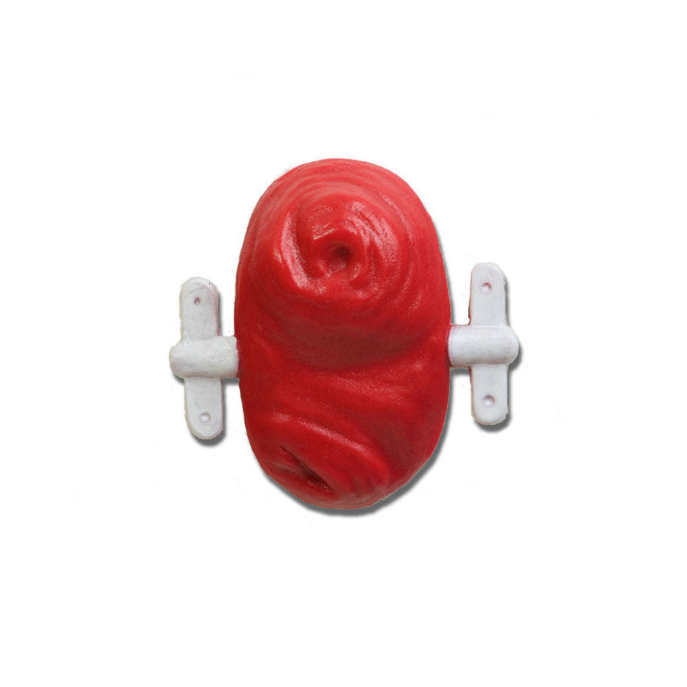 Loop Stoma With Rod For Use With Otto Ostomy