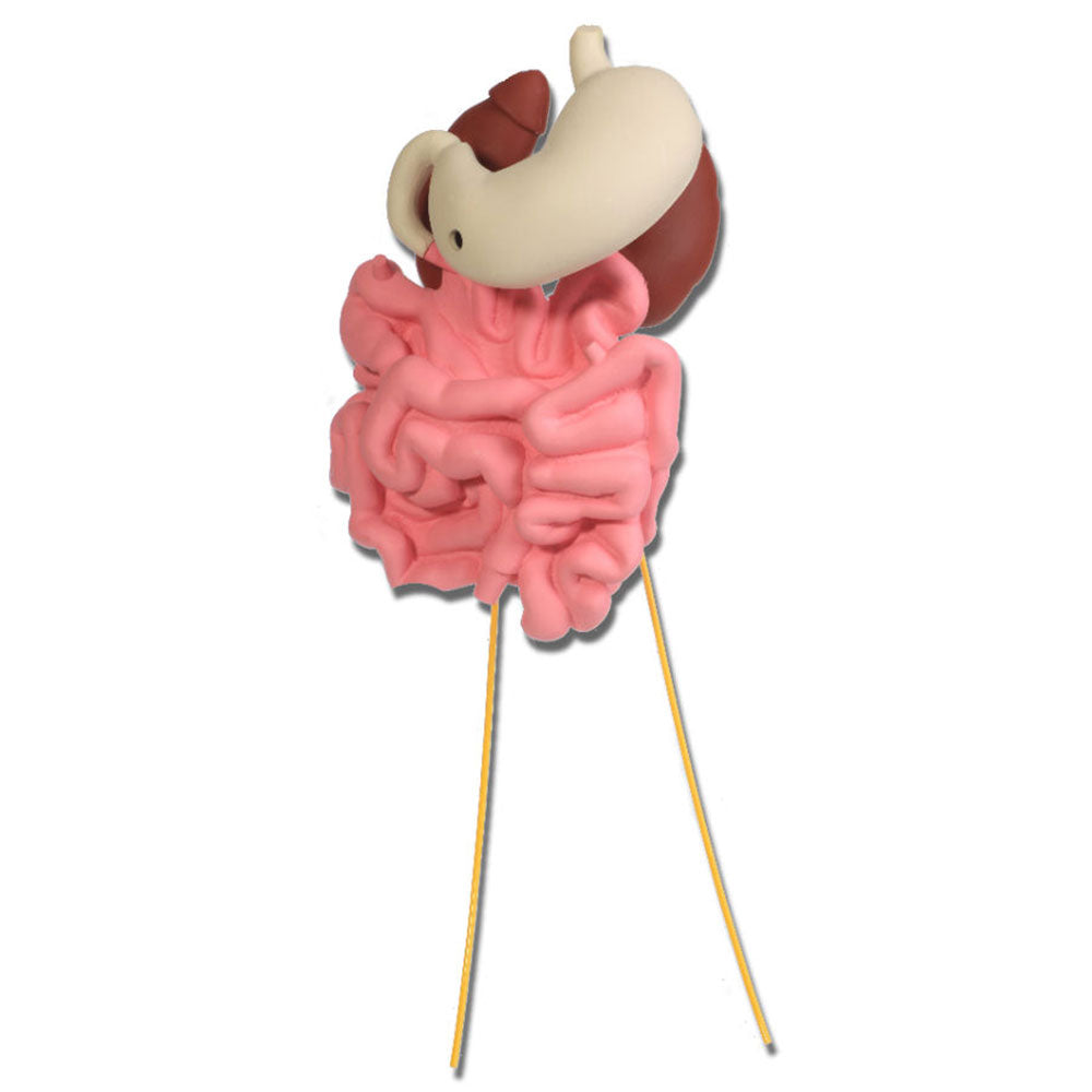 Replacement Small Intestines, Stomach, Right Kidney With Ureters & Left Kidney With Ureters