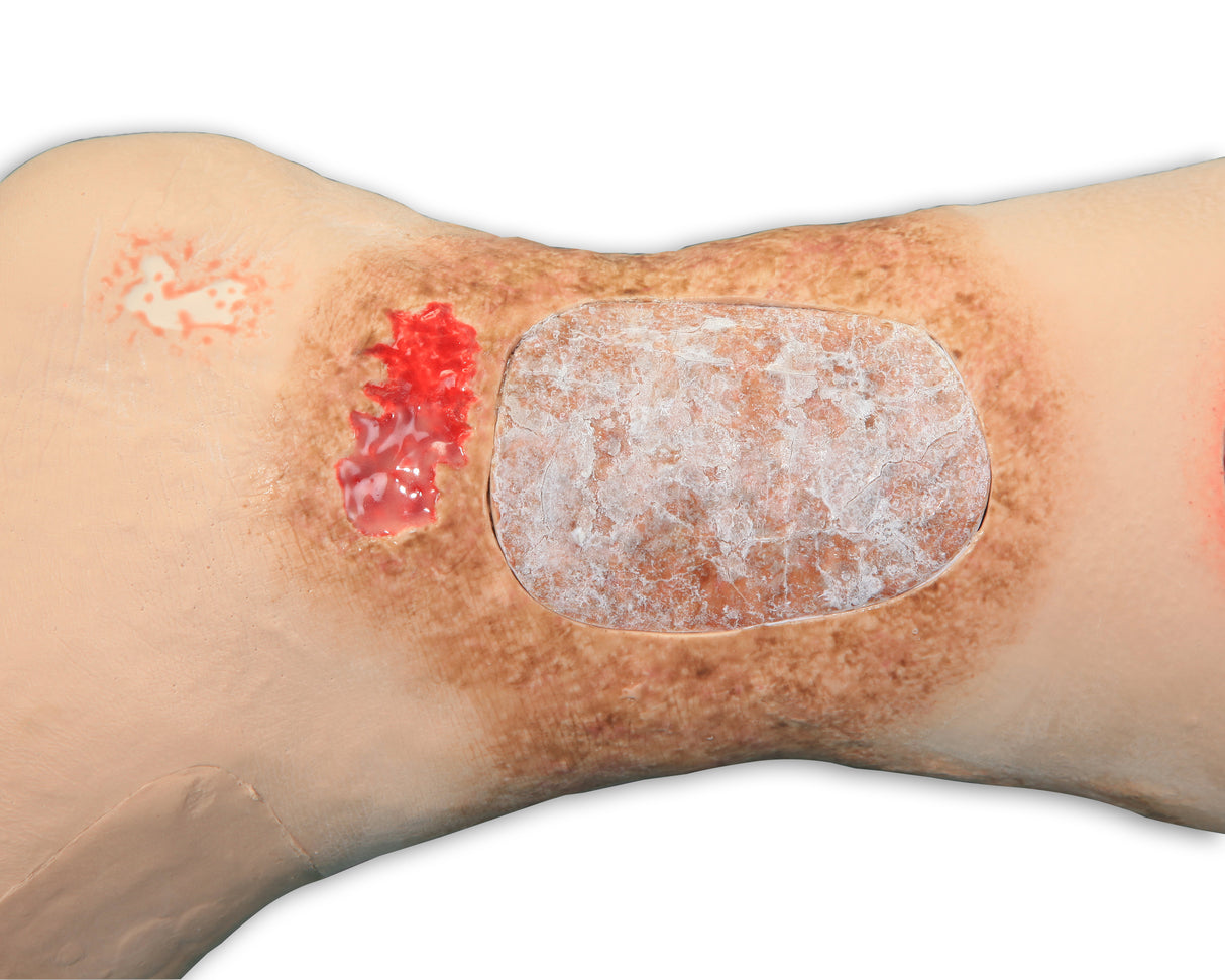 Vinnie Venous Insufficiency Leg Model