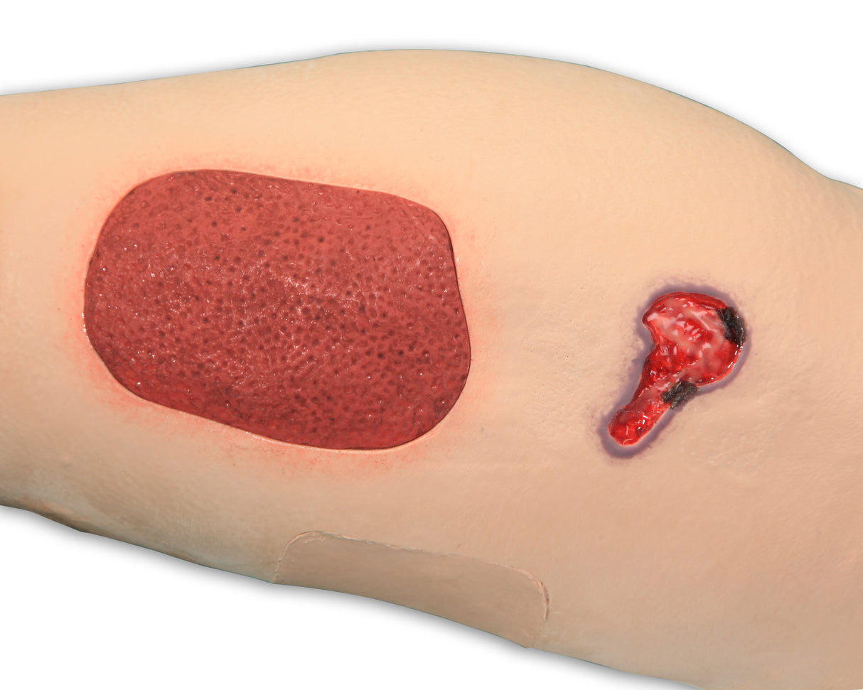 Vinnie Venous Insufficiency Leg Model