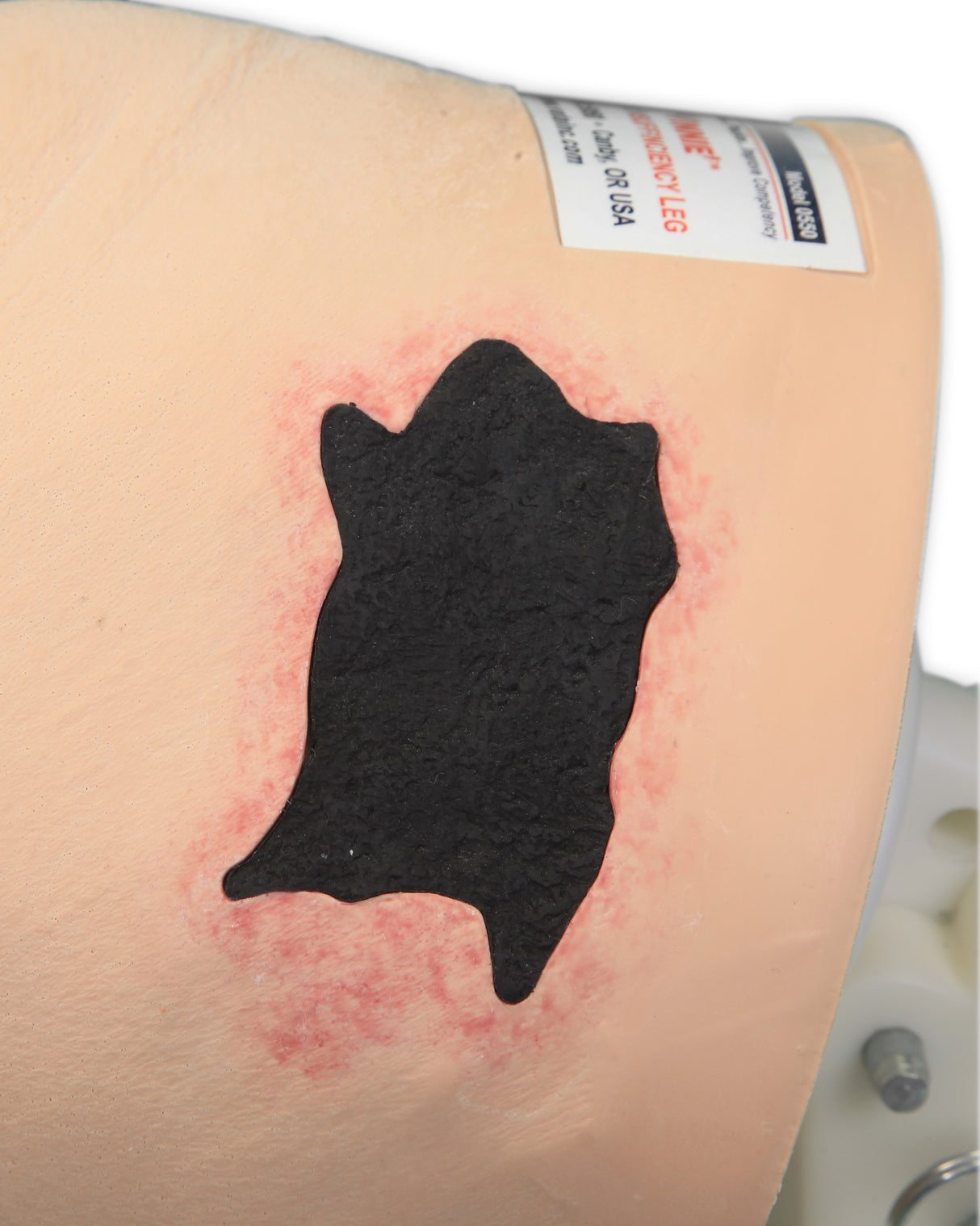 Vinnie Venous Insufficiency Leg Model