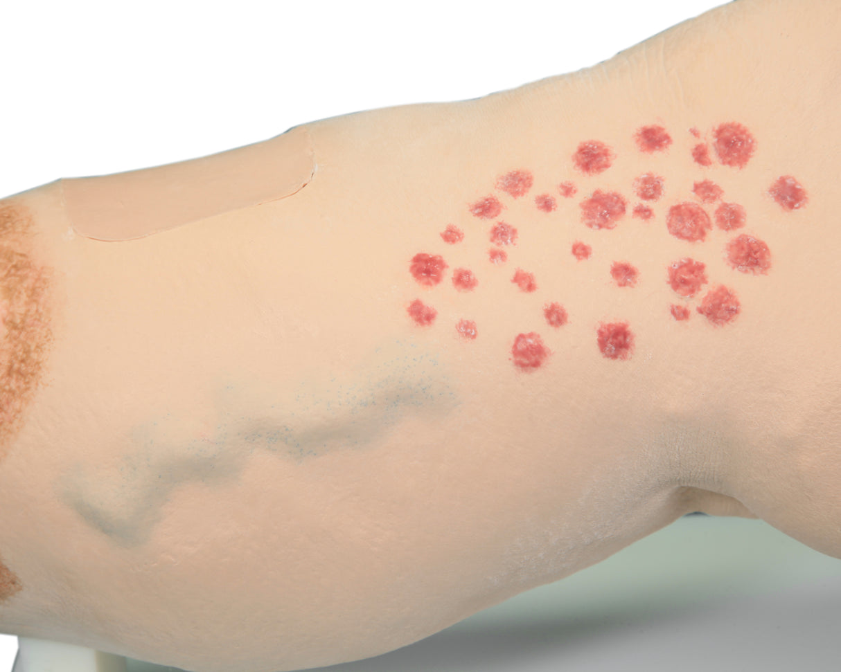 Vinnie Venous Insufficiency Leg Model