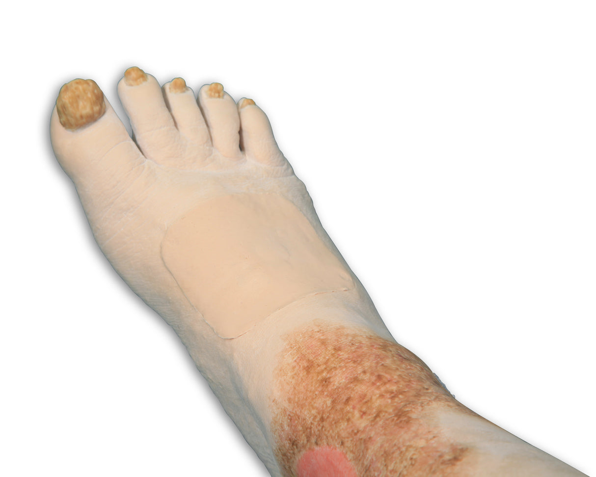 Vinnie Venous Insufficiency Leg Model