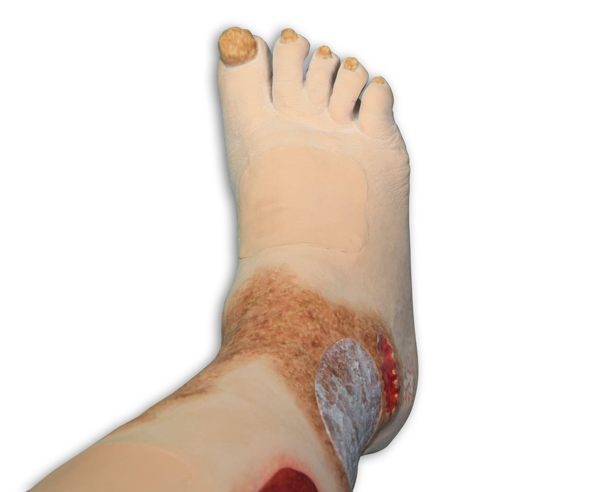 Vinnie Venous Insufficiency Leg Model