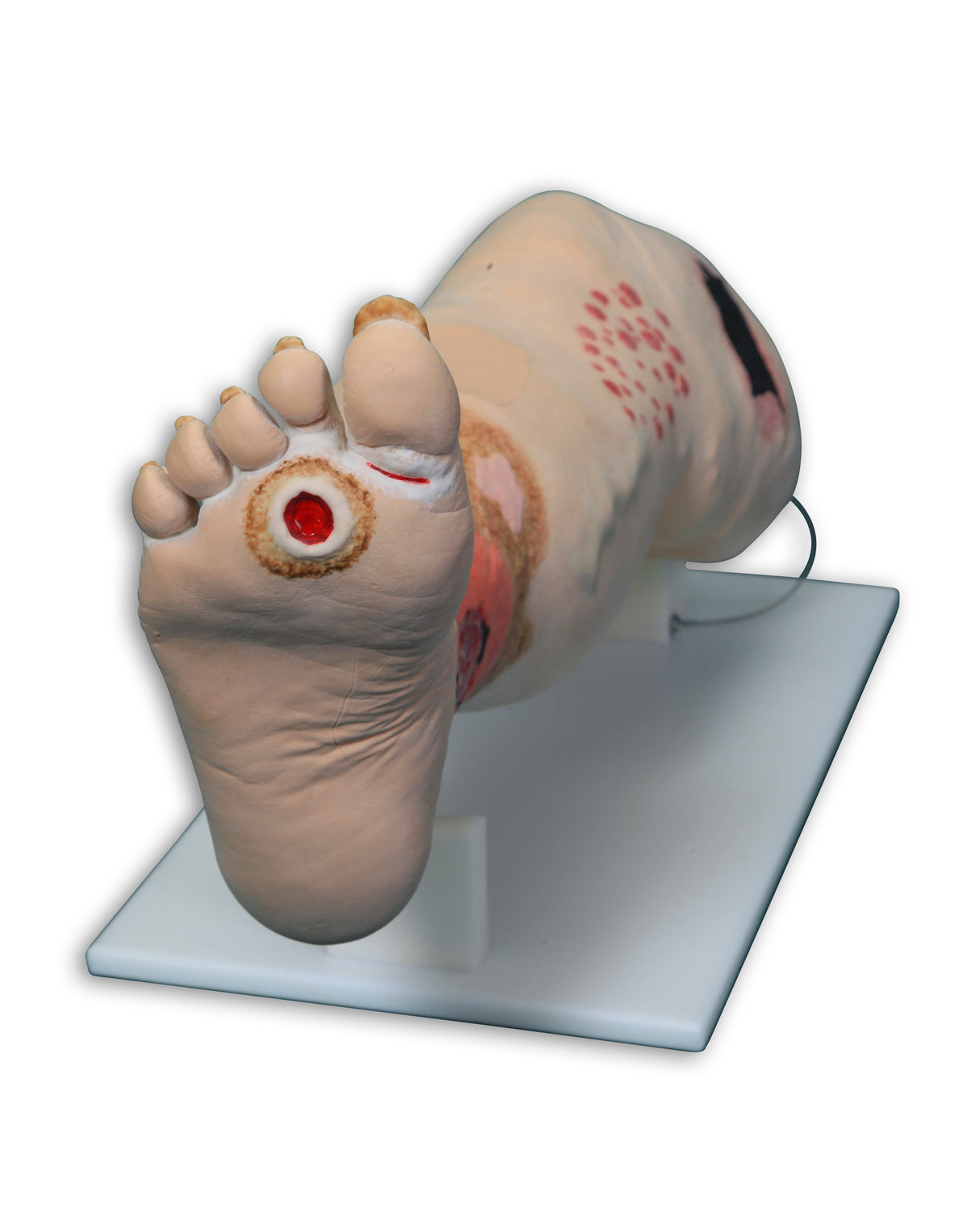 Vinnie Venous Insufficiency Leg Model