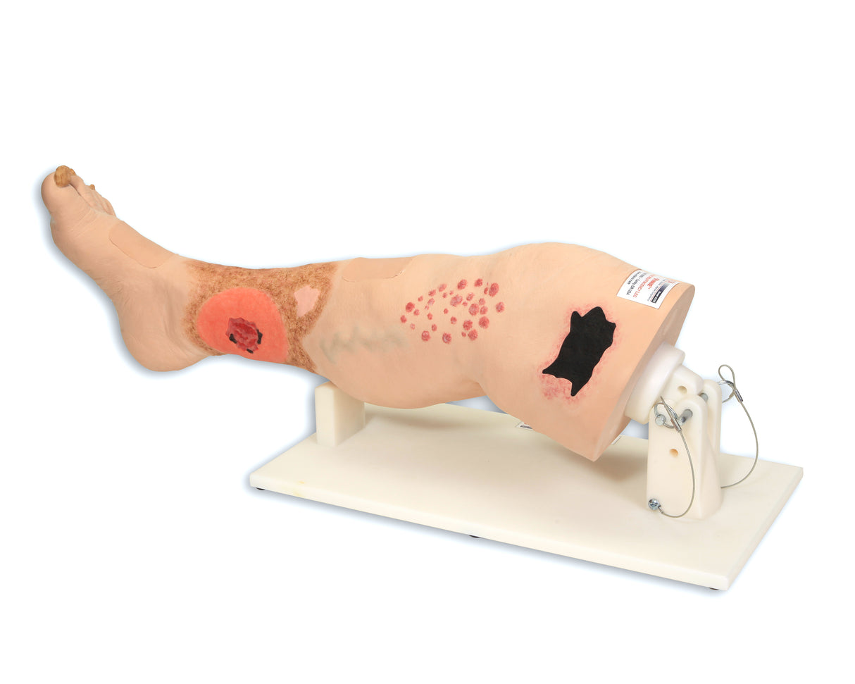 Vinnie Venous Insufficiency Leg Model