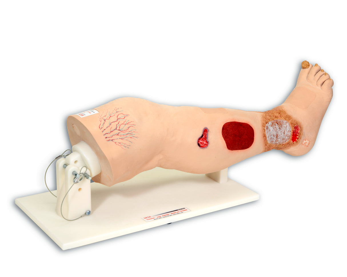 Vinnie Venous Insufficiency Leg Model