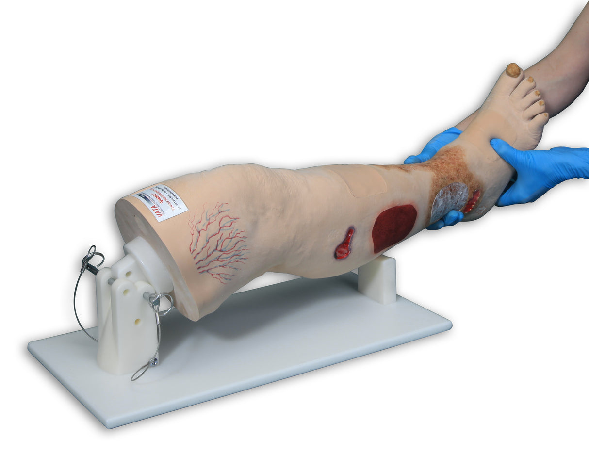 Vinnie Venous Insufficiency Leg Model