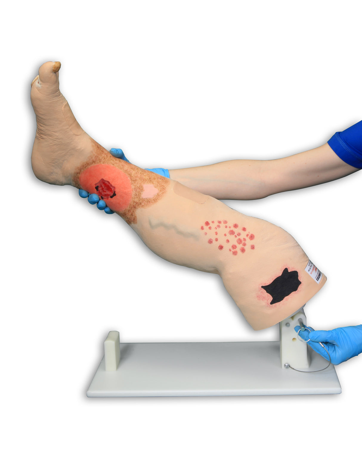 Vinnie Venous Insufficiency Leg Model