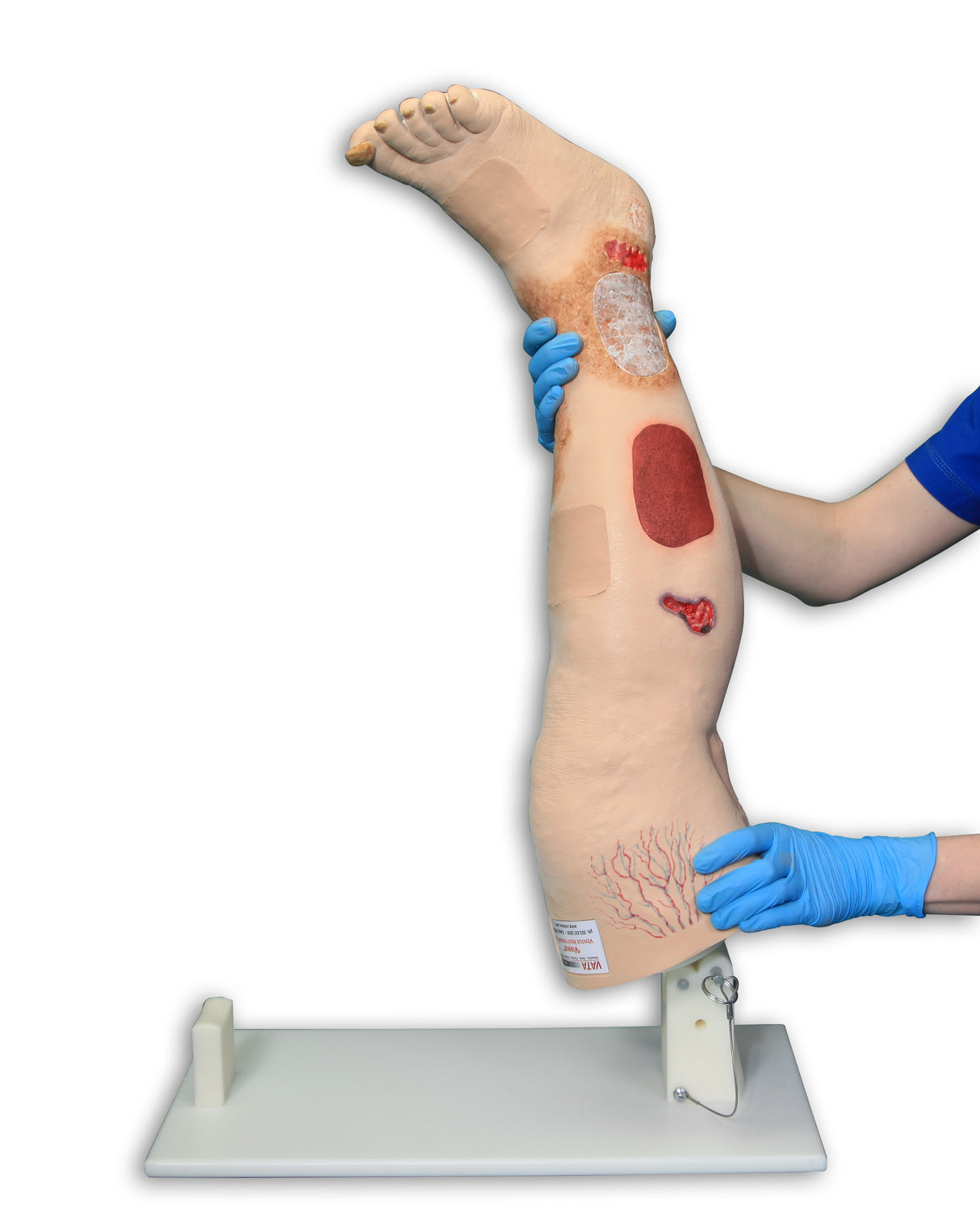 Vinnie Venous Insufficiency Leg Model