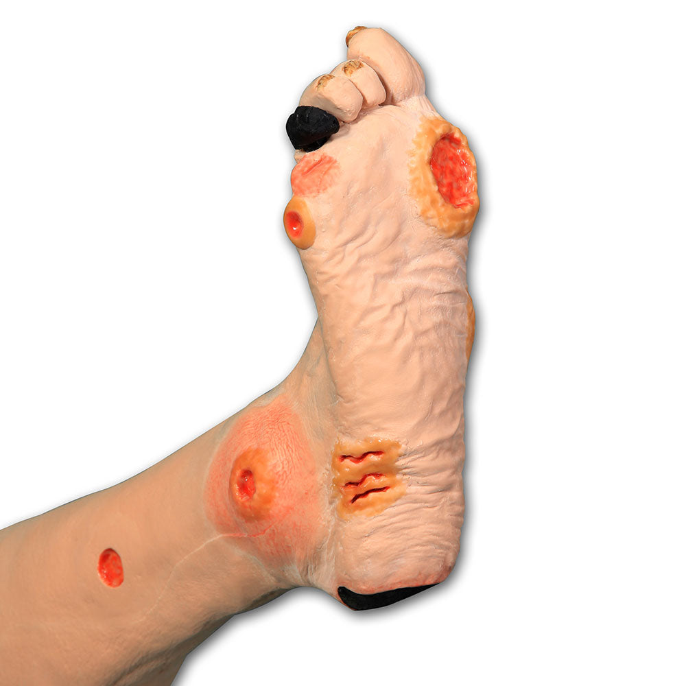 Annie Arterial Insufficiency Leg Model