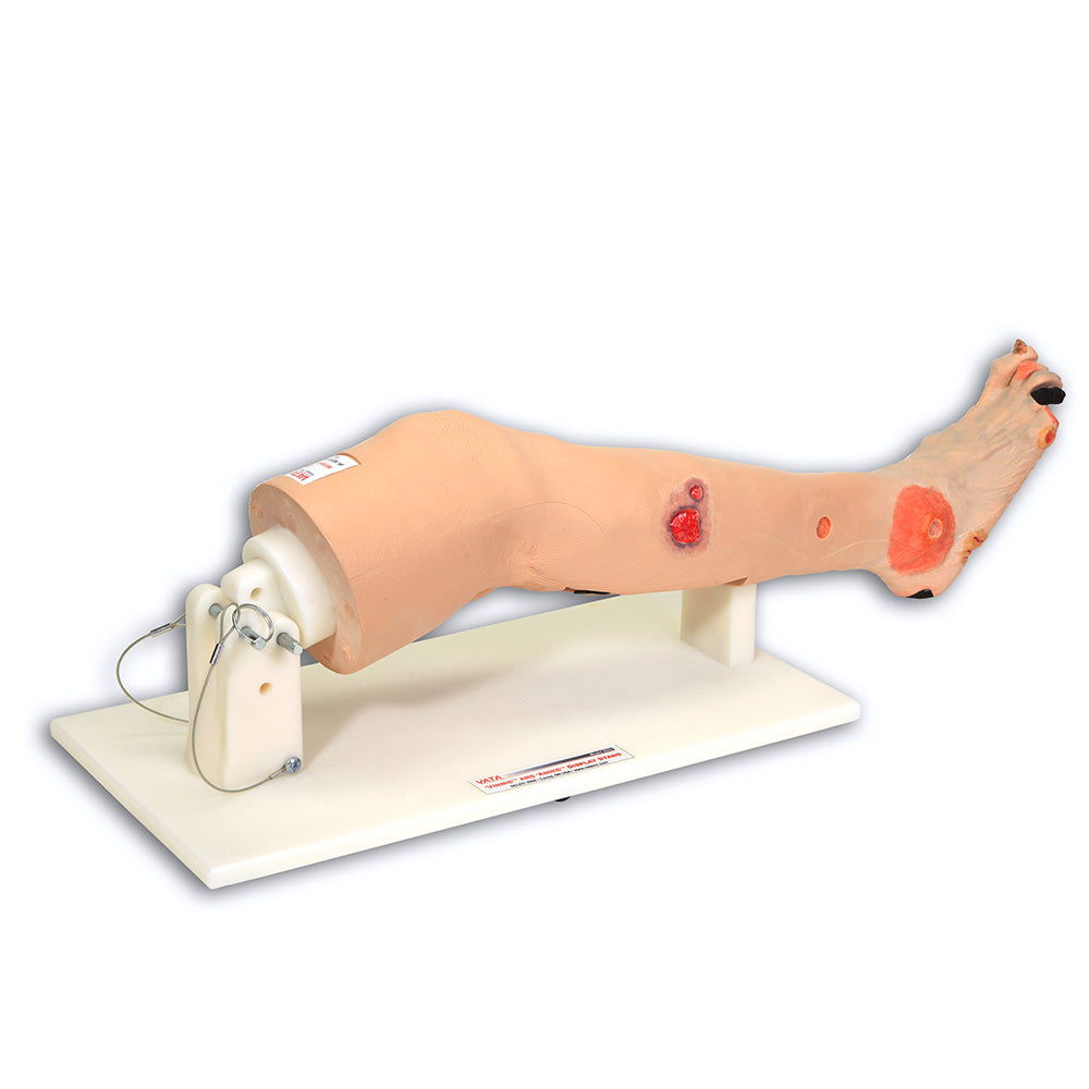 Annie Arterial Insufficiency Leg Model