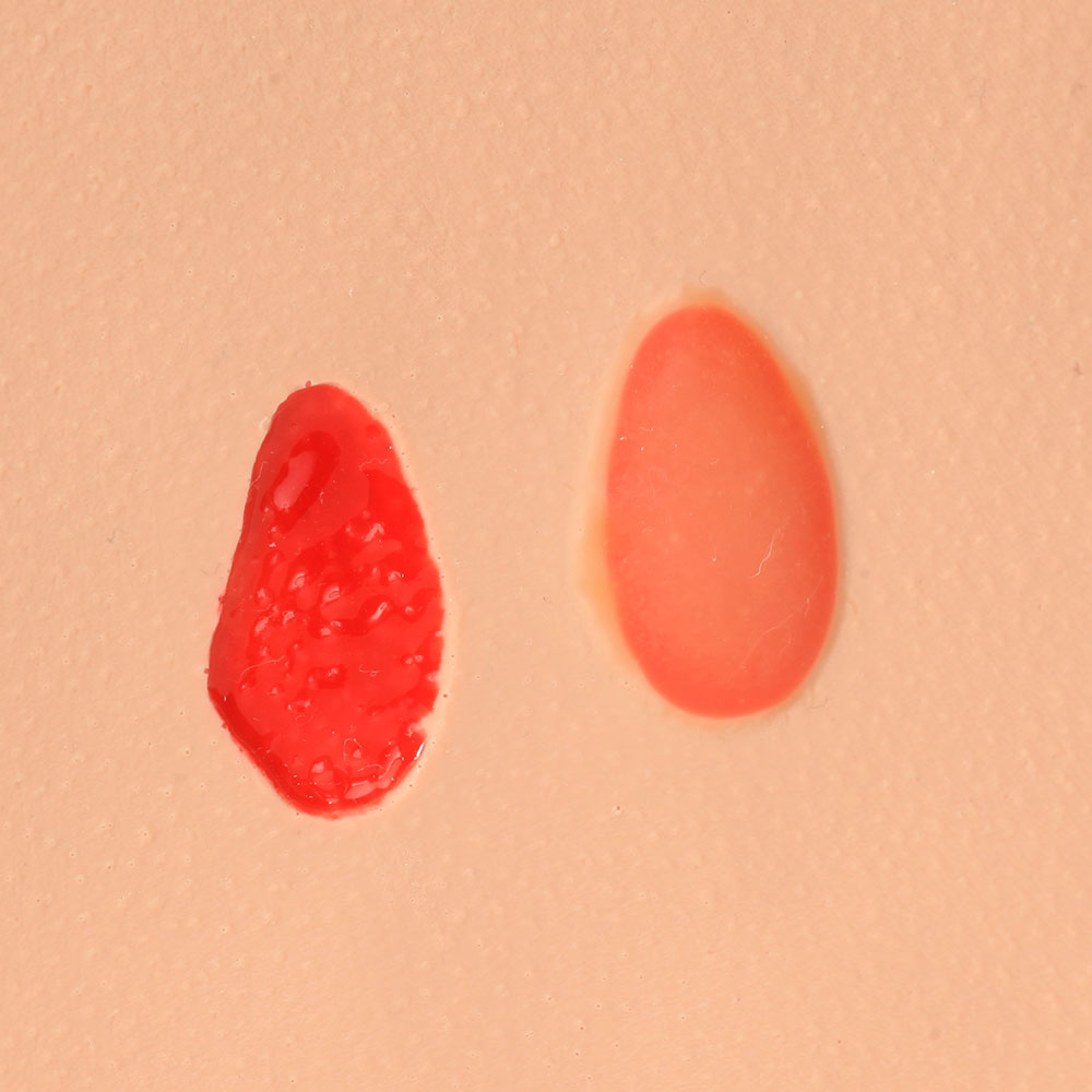 Pat Pressure Injury Staging Model™