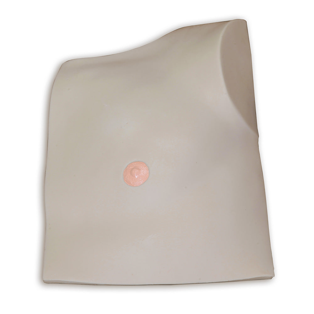 Outer Tissue Flap Replacement For Chester