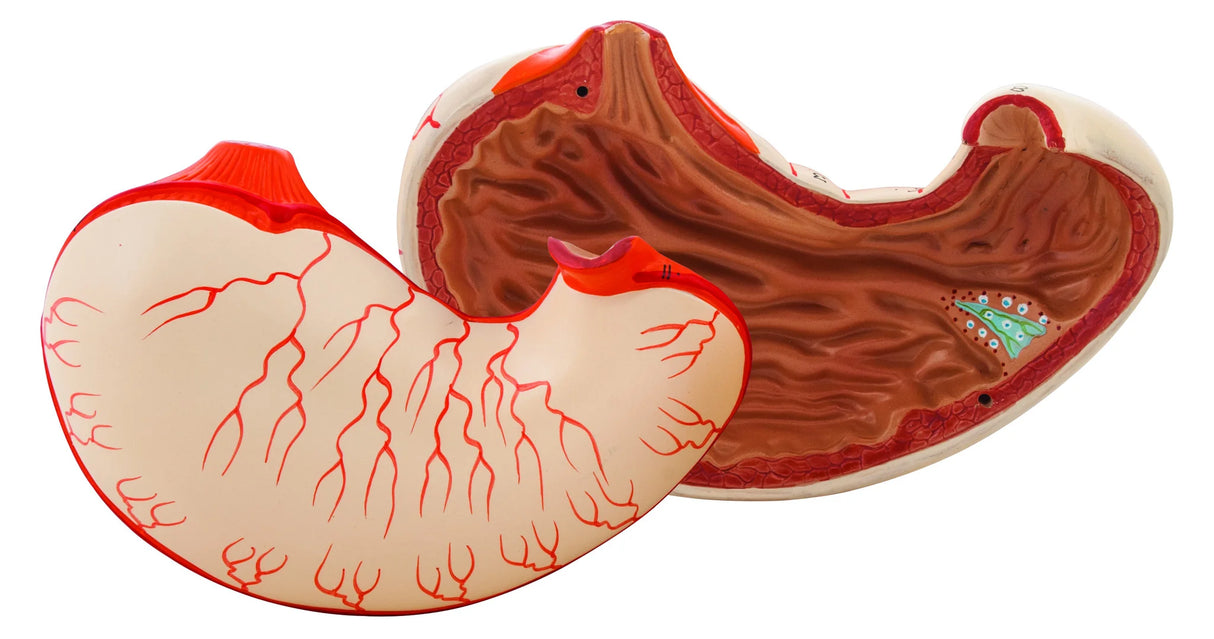 Human Stomach Model, 2 Parts