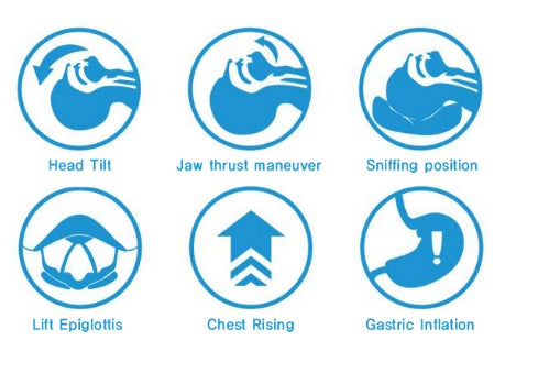 Airway Management Trainer