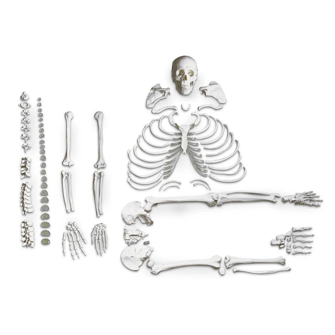 Disarticulated Skeleton