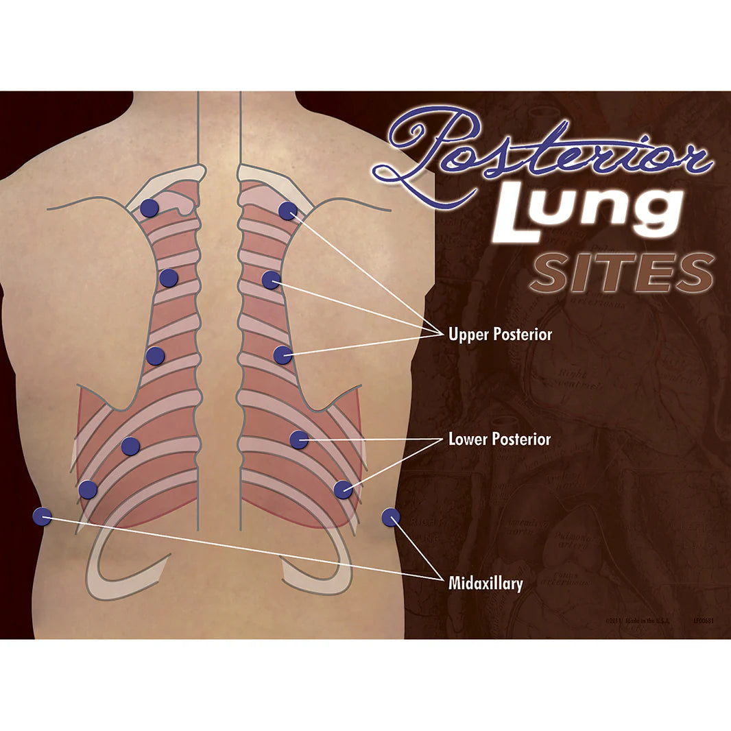 Posterior Heart & Lung Sites Poster