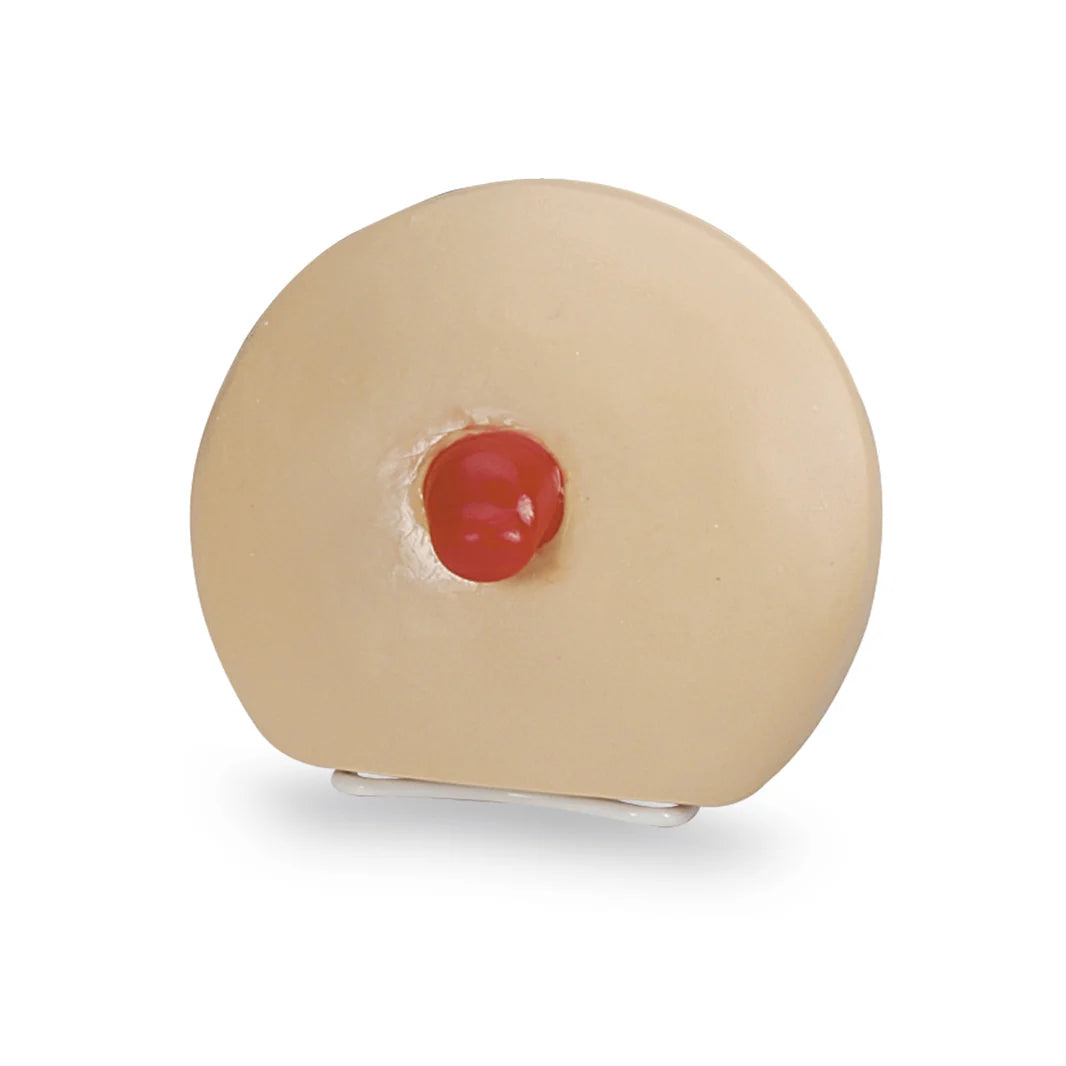 Prolapsed Ostomy Model