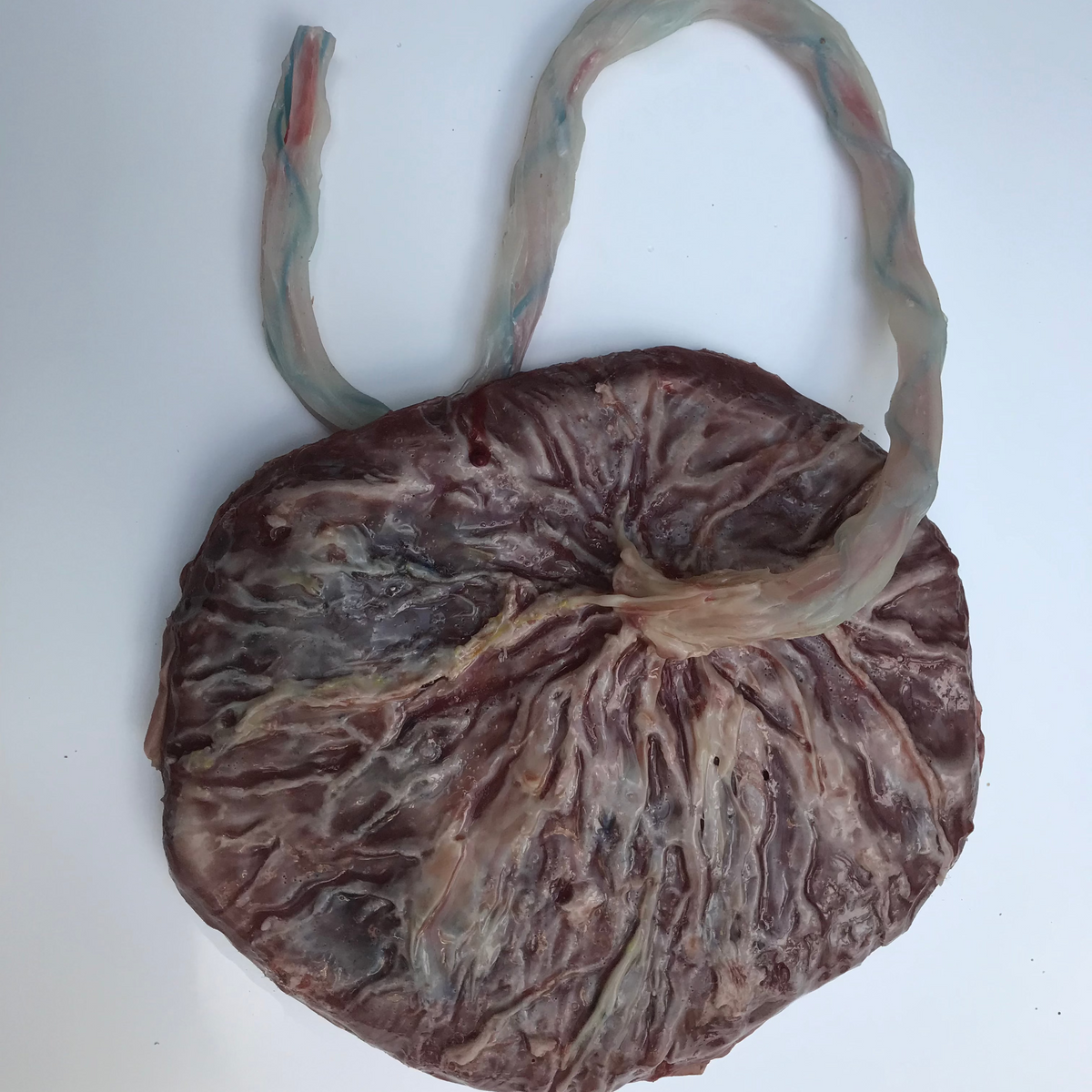 MedicFX Full Term Placenta and Umbilical Cord – Anchor Simulation