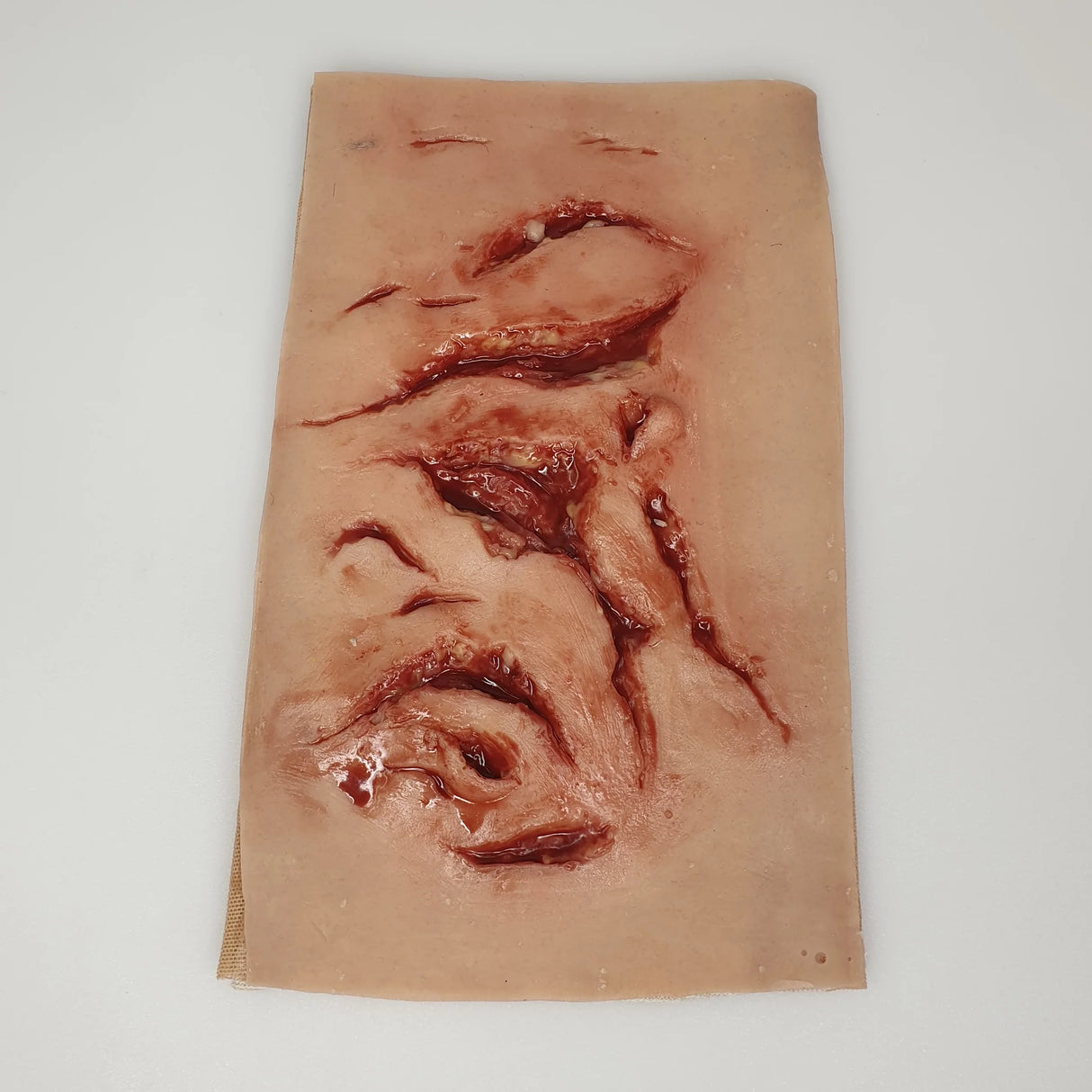 Multiple Lacerations