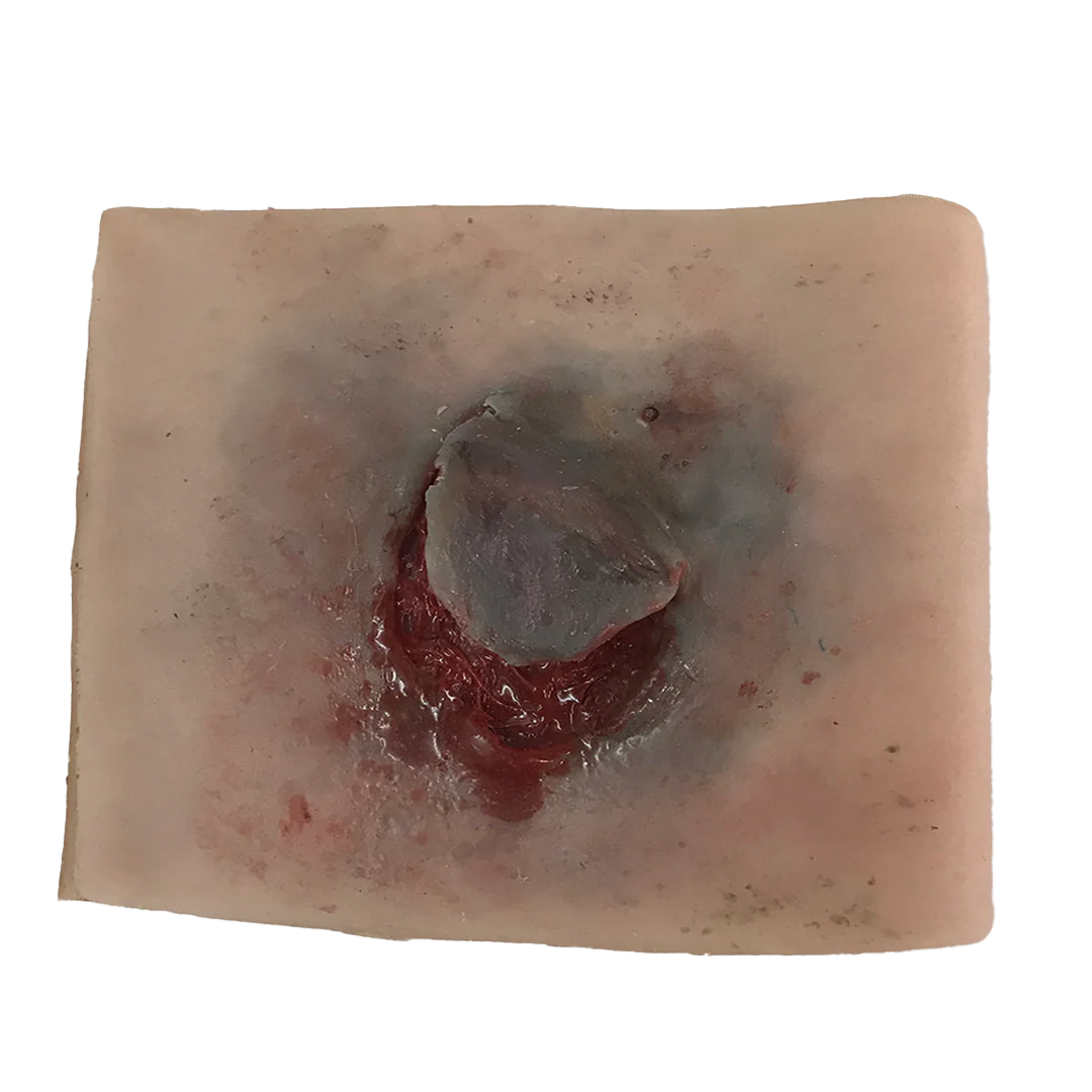 Elderly Skin Tear
