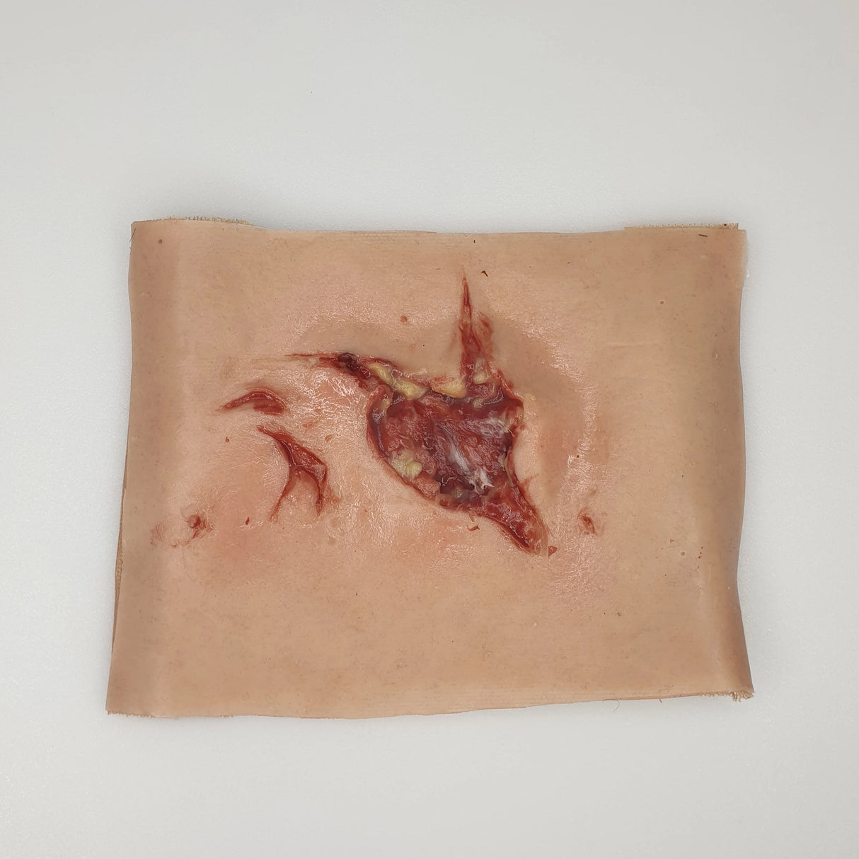 Open Wound