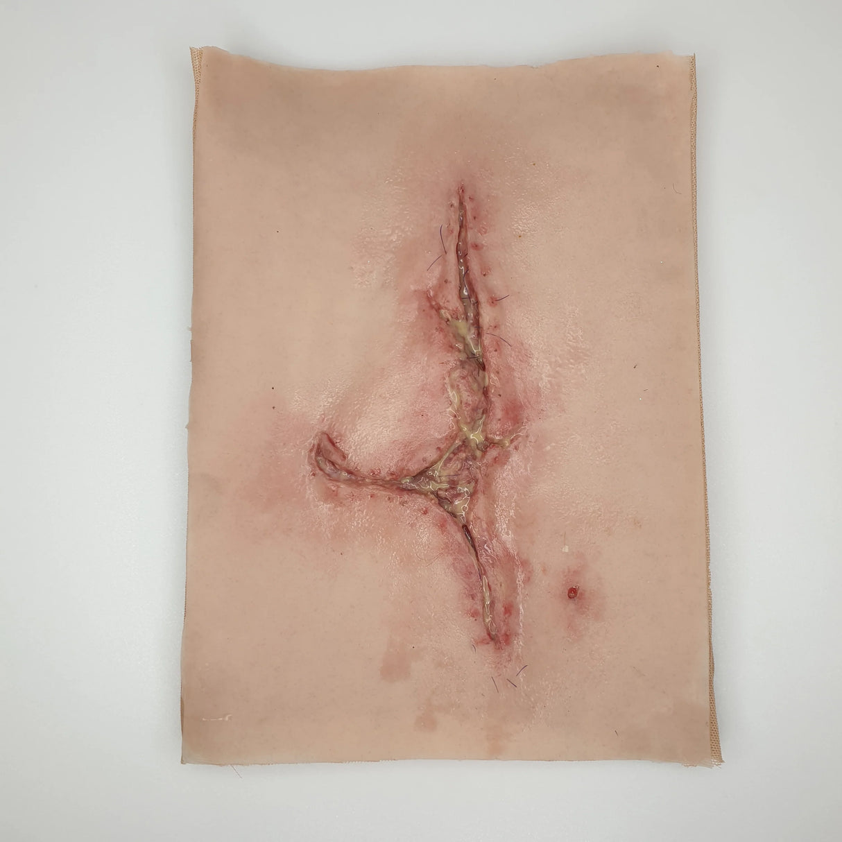 Large Infected Leg Wound