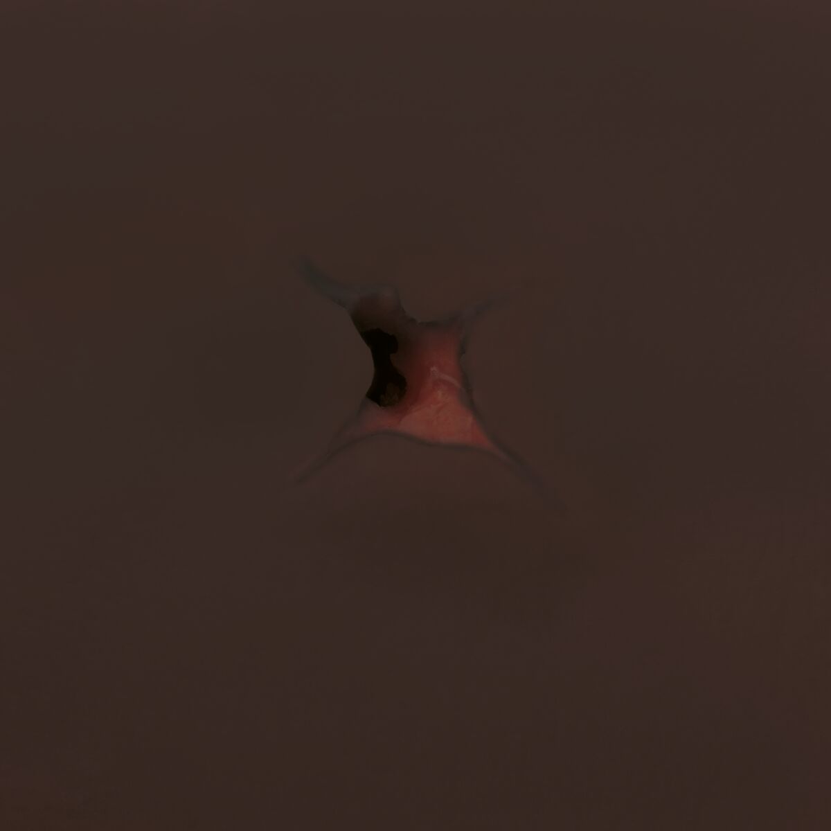 Hemorrhage Control Arm Trainer