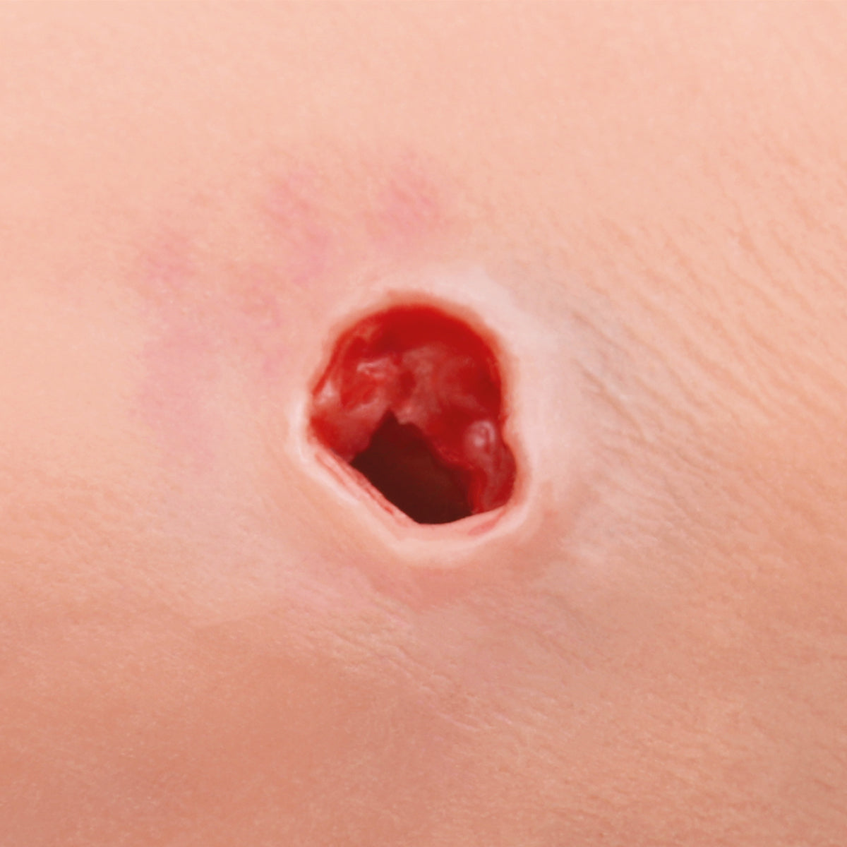 Hemorrhage Control Arm Trainer