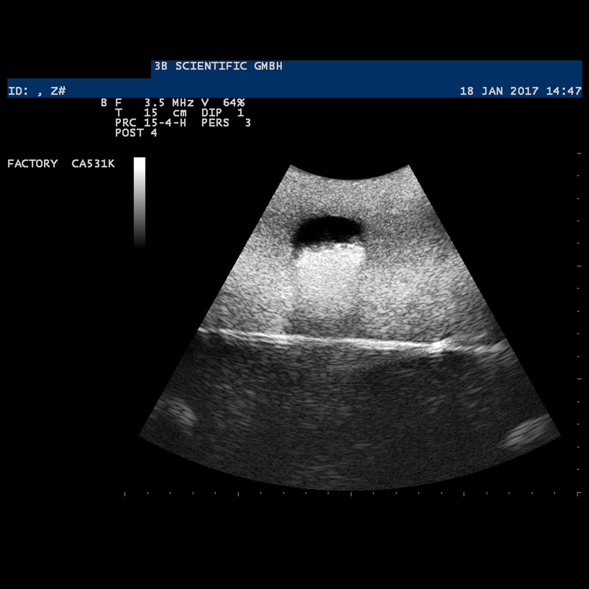 SONOtrain™ Ultrasound Vein Model