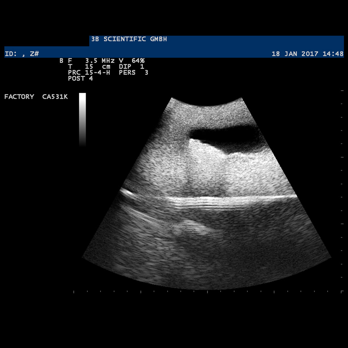 SONOtrain™ Ultrasound Vein Model