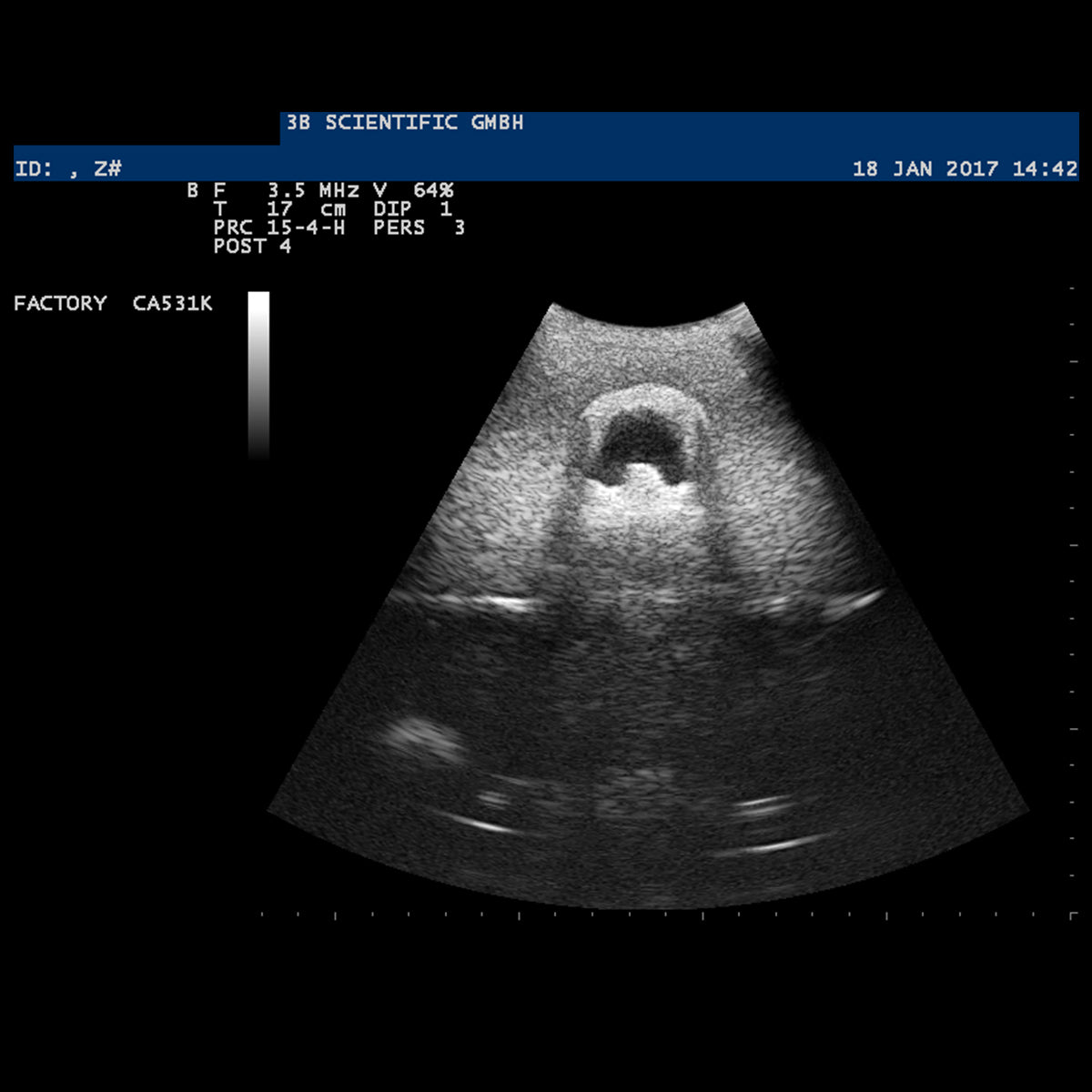 SONOtrain™ Ultrasound Vein Model