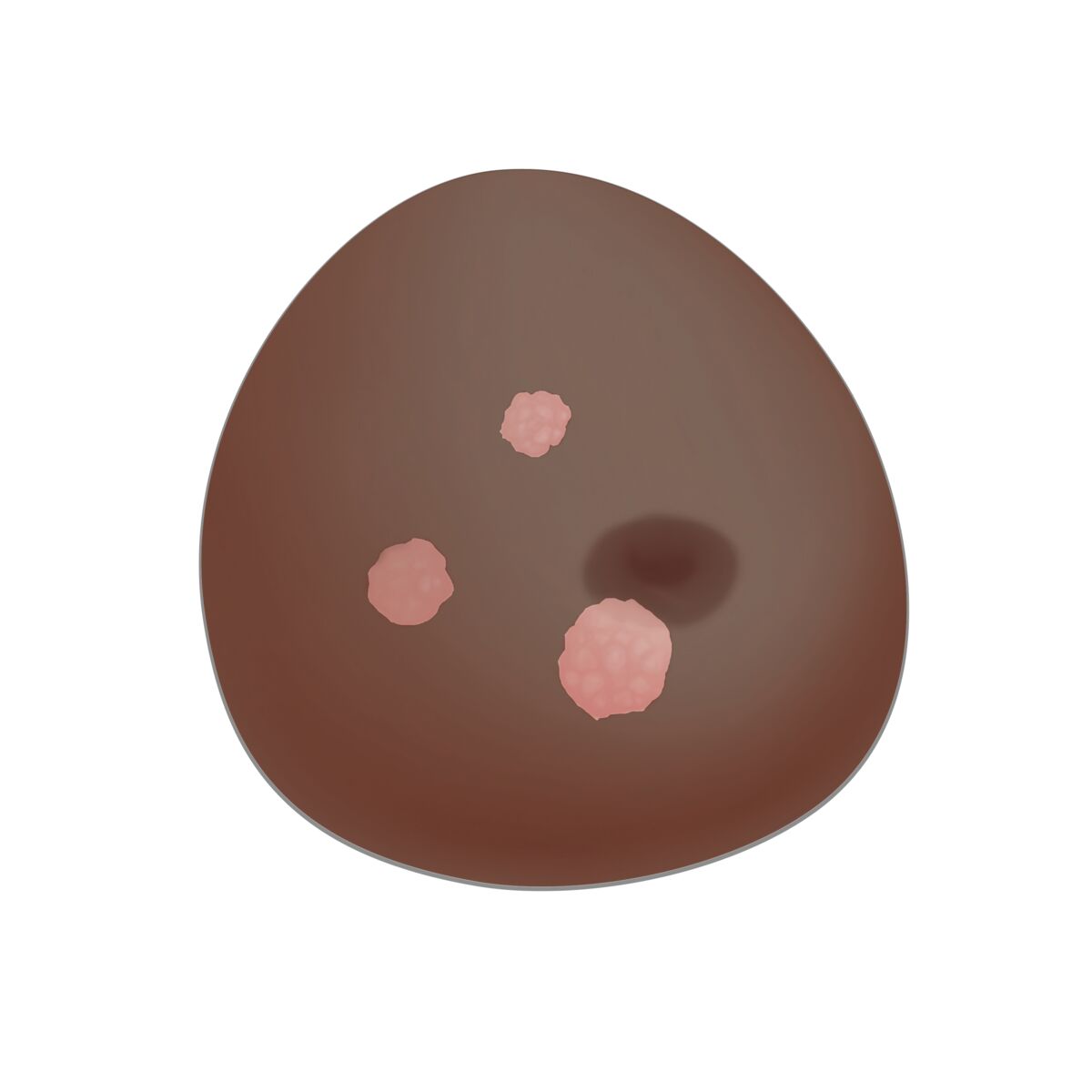 SONOtrain™ Breast Model