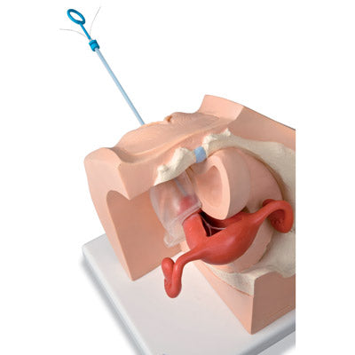 Gynecological Training Model for Patient Education - 3B Smart Anatomy