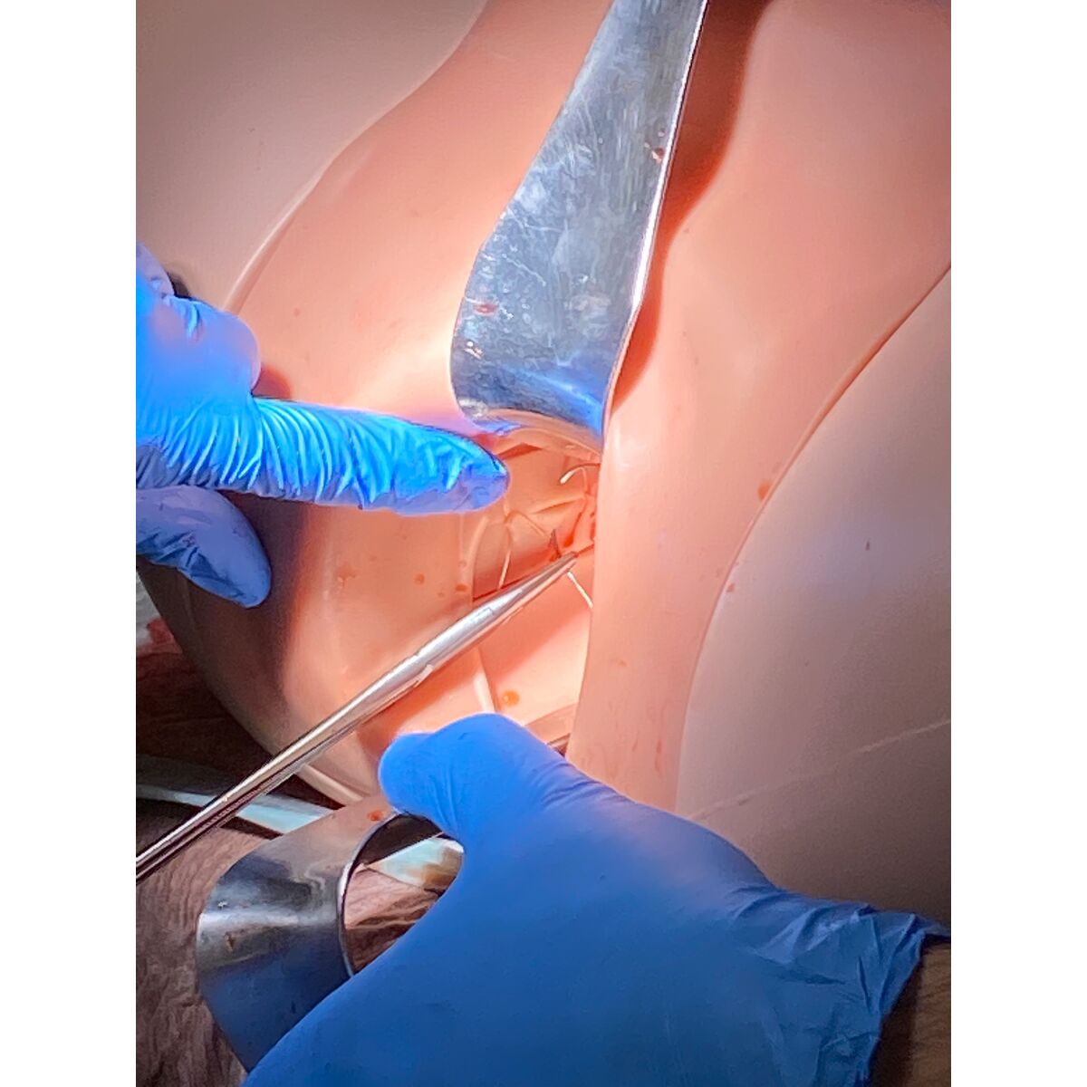 Postpartum Hemorrhage Simulator PRO