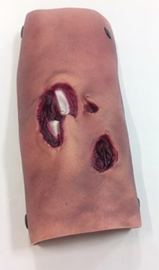 Burnt Tibia