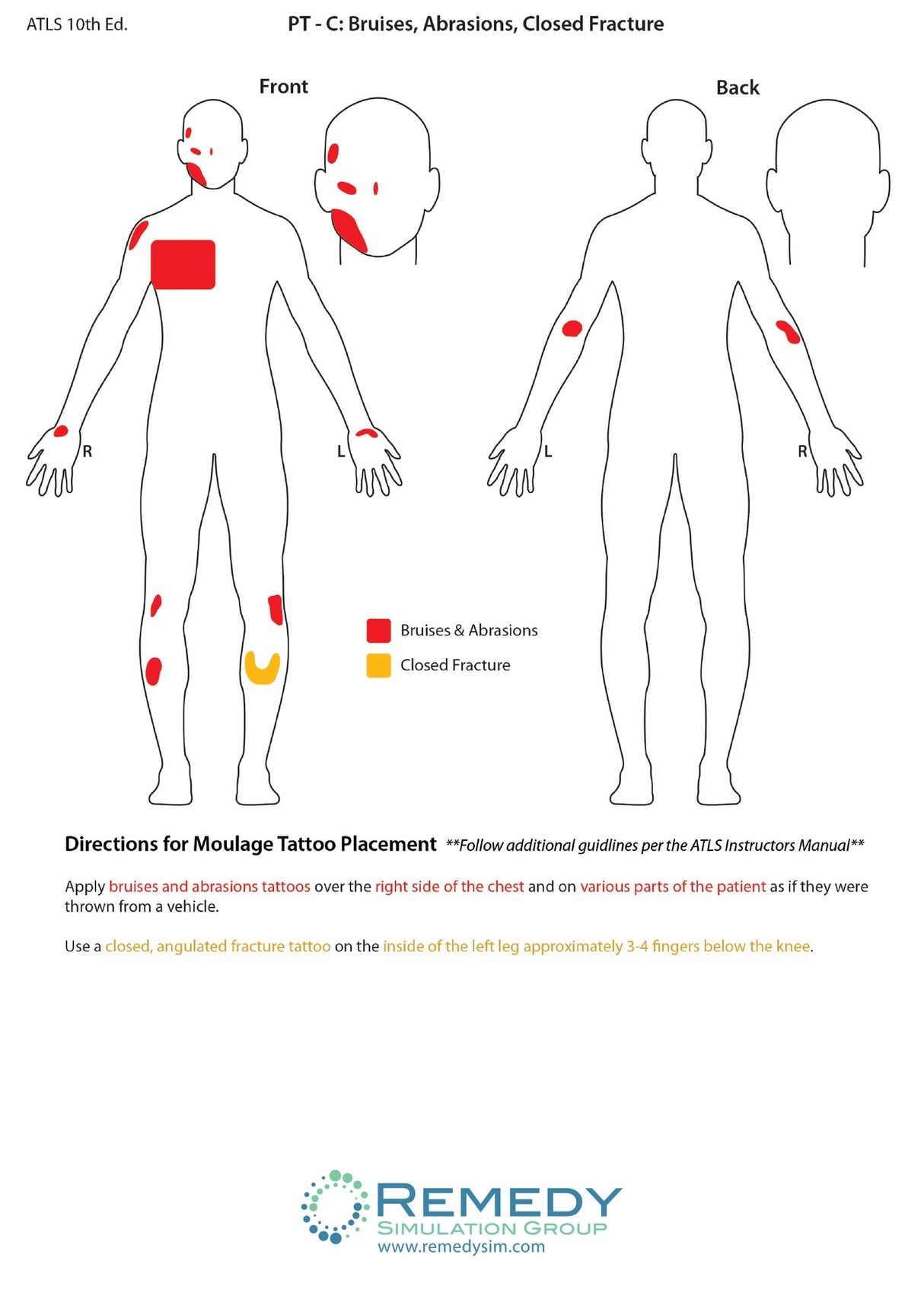 Moulage Tattoo Patient C Scenario