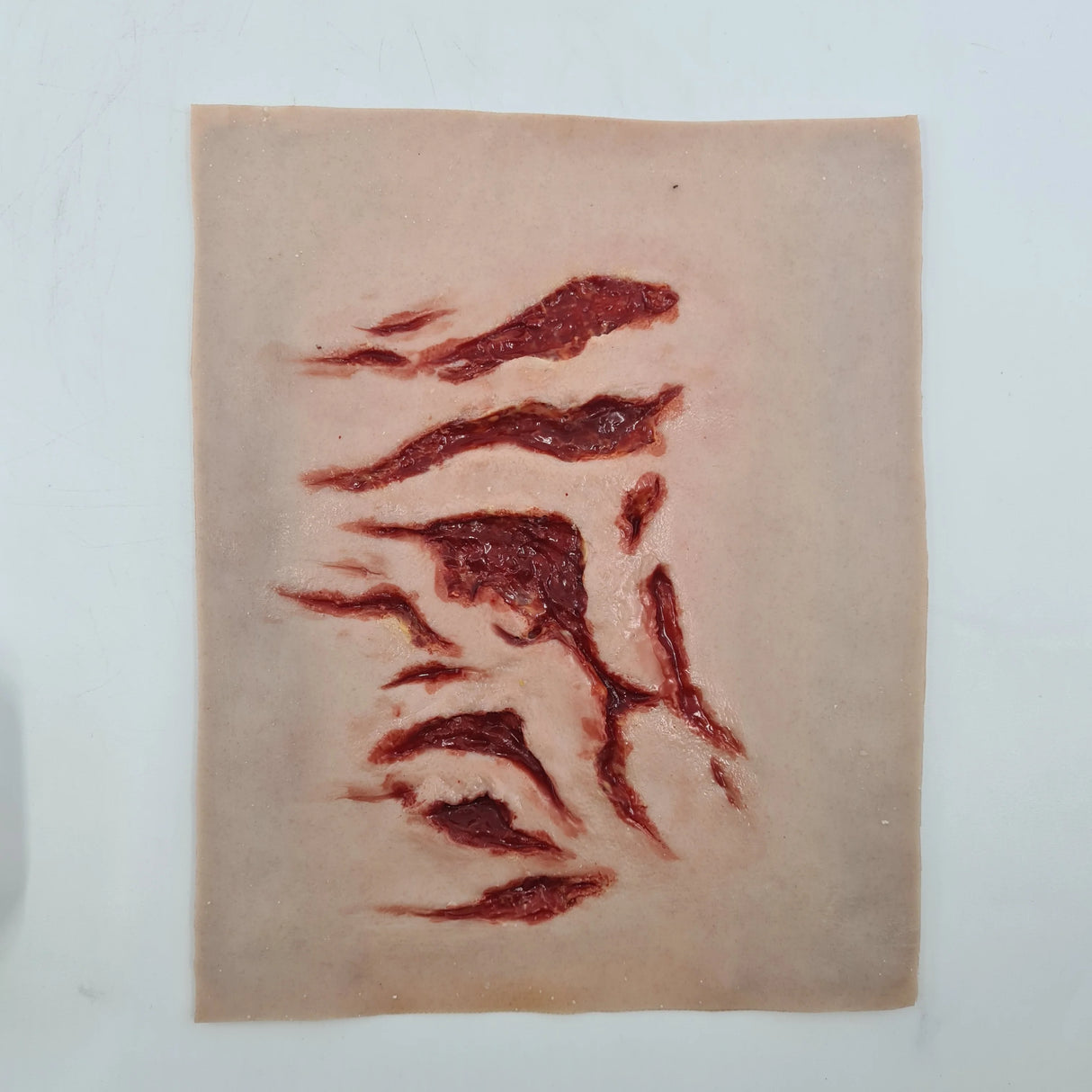 Multiple Lacerations