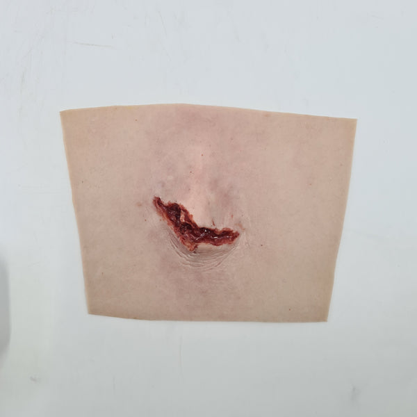 Broken Tibia Trauma