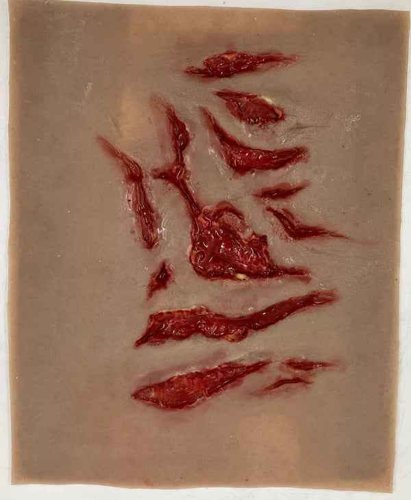 Multiple Lacerations
