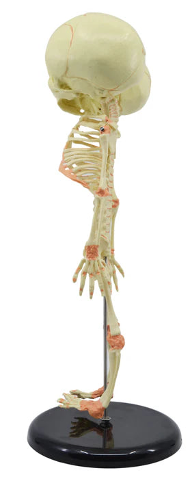 Mini Size Infant Fetus Skeleton Model, Twin, Conjoined Skull