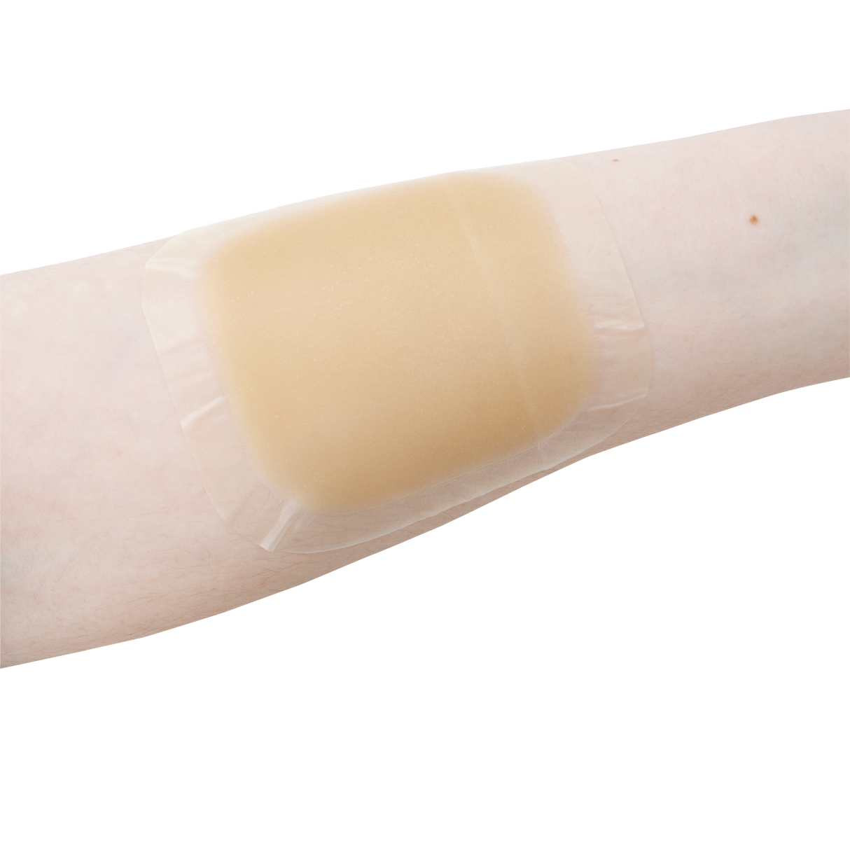 DynaDerm™ Hydrocolloid Dressings