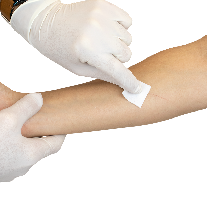 Sterile Alcohol Prep Pads