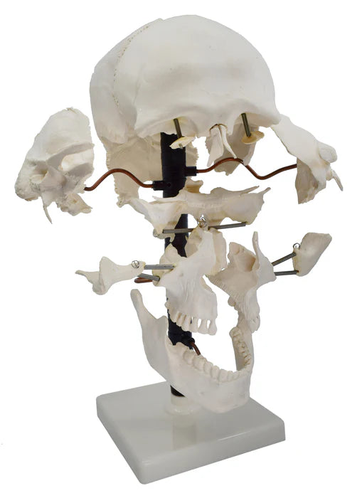 Beauchene Skull Life Size Model, 13 Parts Mounted on Stand