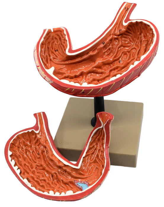 Human Stomach Model 3 Dimensional Sectional View, 2 Parts