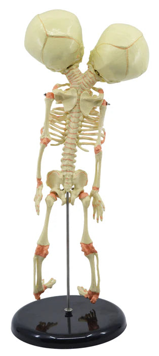 Mini Size Infant Fetus Skeleton Model, Twin, Conjoined Skull