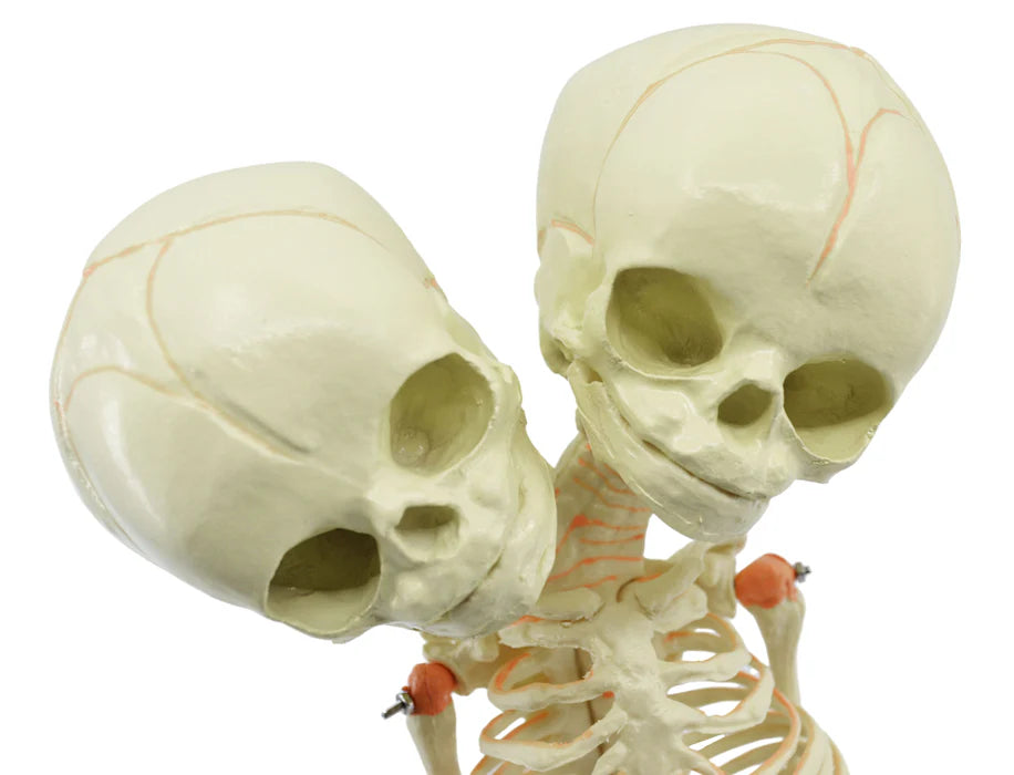 Mini Size Infant Fetus Skeleton Model, Twin, Conjoined Skull
