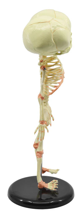 Mini Size Infant Fetus Skeleton Model, Twin, Conjoined Skull