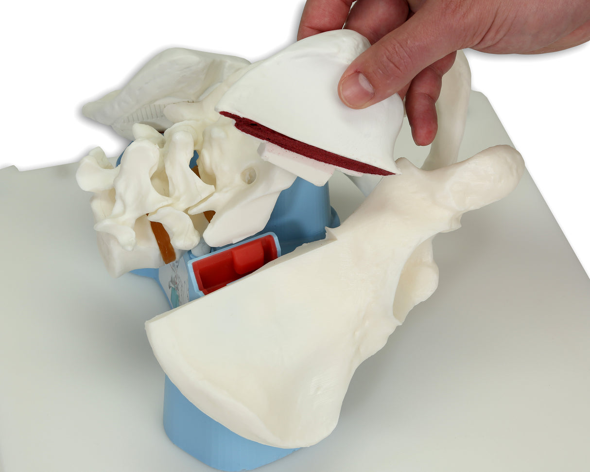Bonnie Bone Marrow Biopsy™ Skills Trainer With Case & 5-Pack Of Illiac Crest Inserts